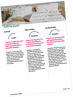 Résultats de l'analyseur d'impact